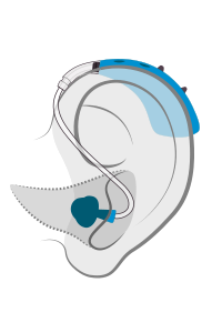 bte_hearing-aid-style bte_hearing-aid-style