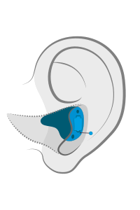 hearing-aid-styles_final_cic hearing-aid-styles_final_cic
