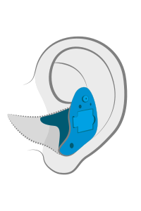 hearing-aid-styles_final_ite hearing-aid-styles_final_ite