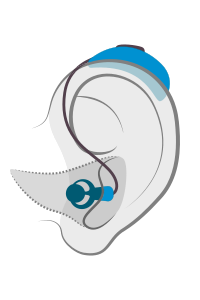 hearing-aid-styles_final_ric hearing-aid-styles_final_ric